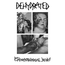 DEHYDRATED - Psychopathological Years (TAPE)